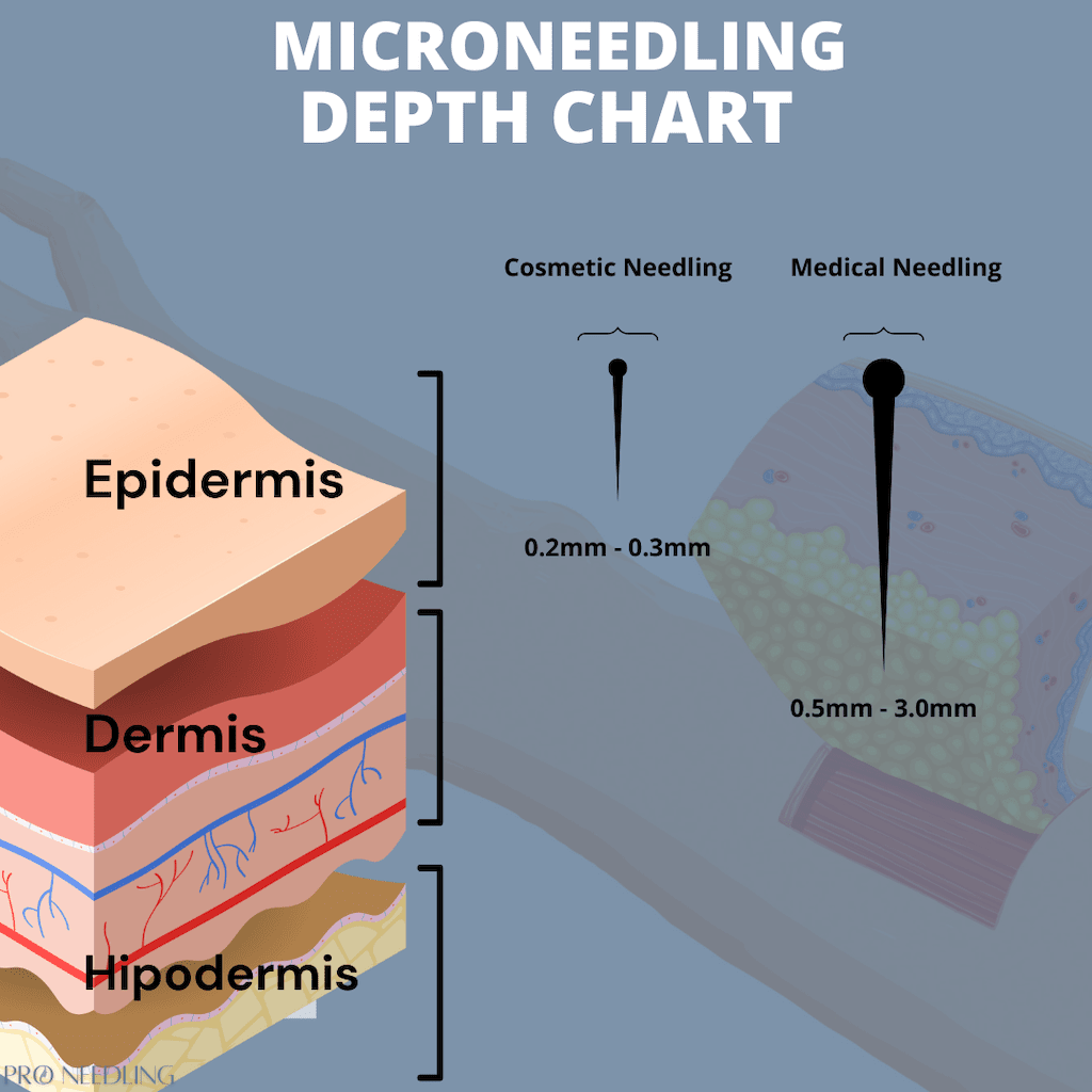 microneedling depth guide