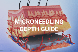 microneedle depth