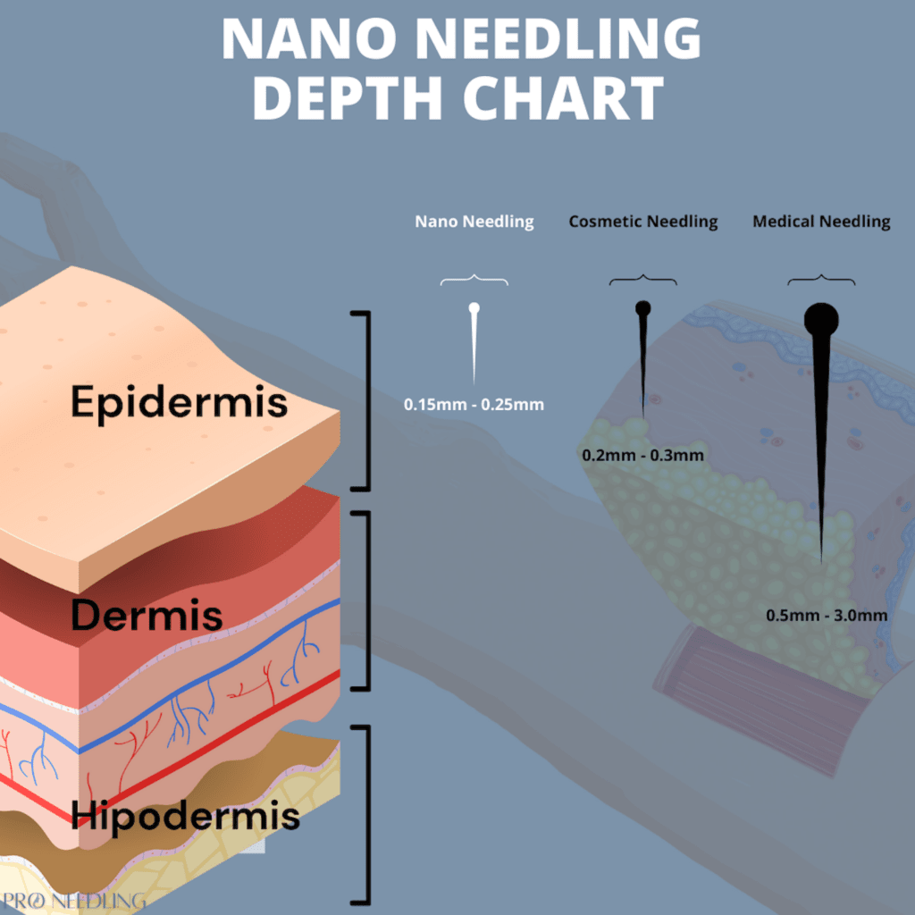 nano needling depth chart