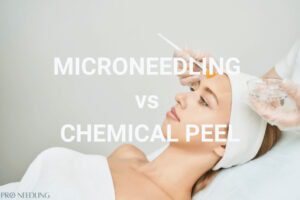microneedling vs chemical peel
