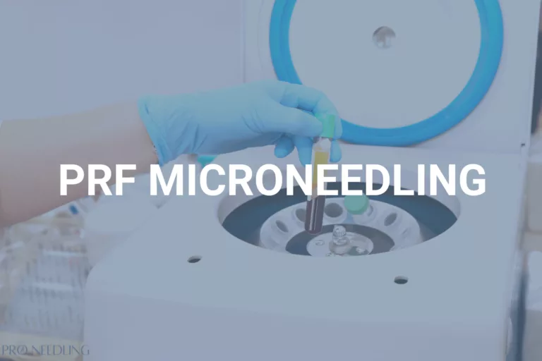 Microneedling with PRF